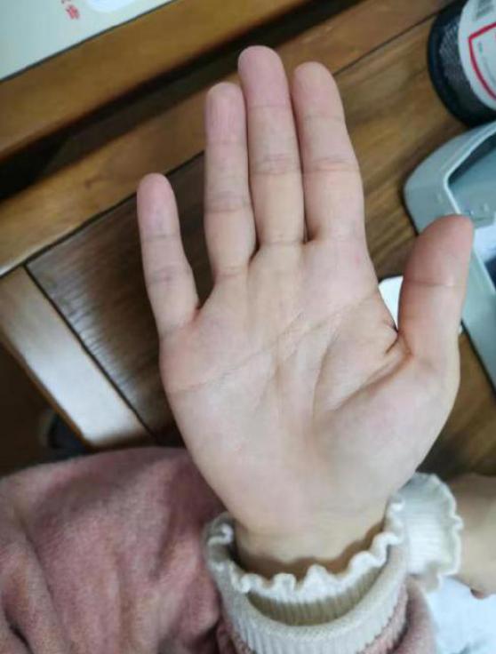 湿疹中医治疗_湿疹 根治_失眠伴湿疹治疗