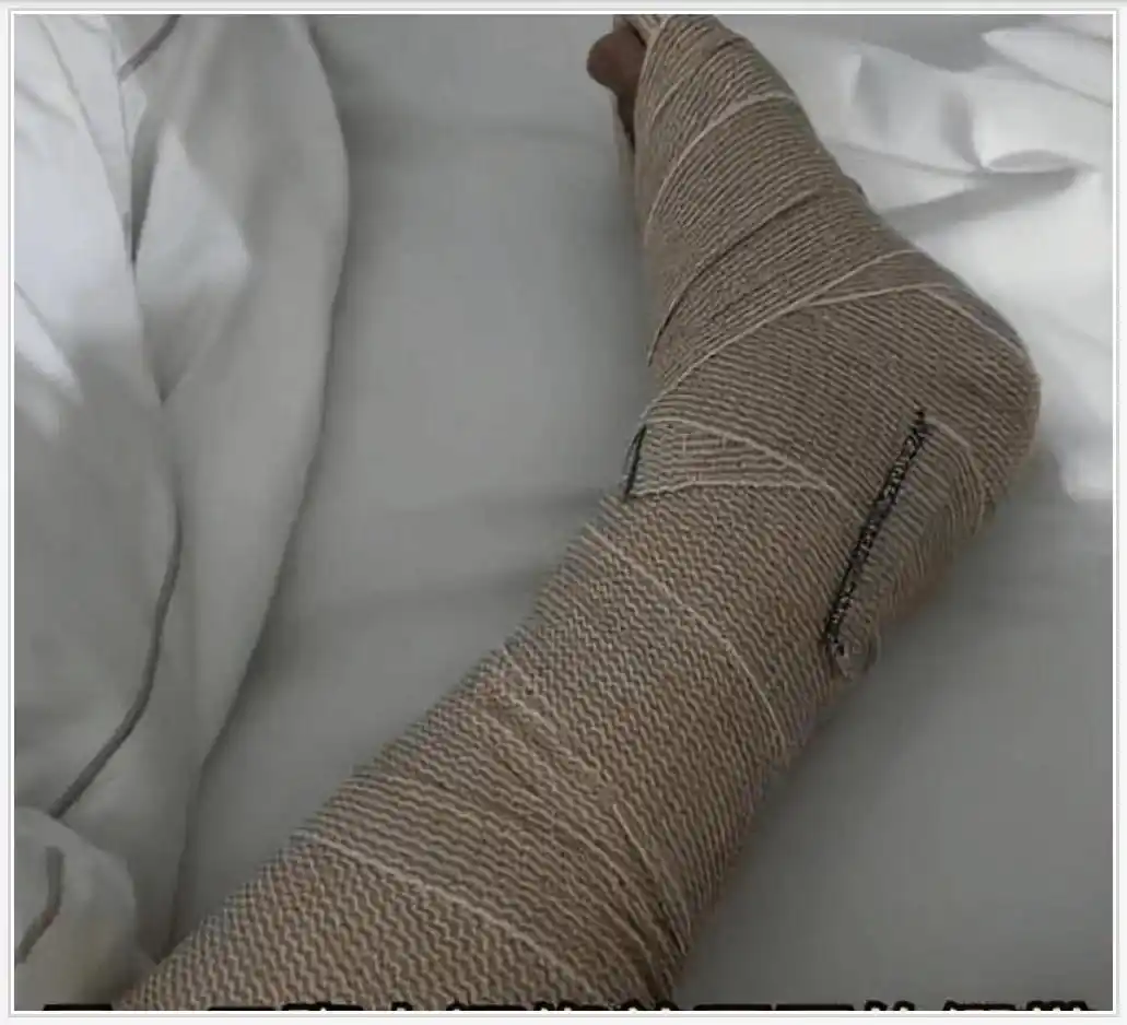 陈学冬照片_陈学冬小时代角色重合_陈学冬车祸右脚手术经历