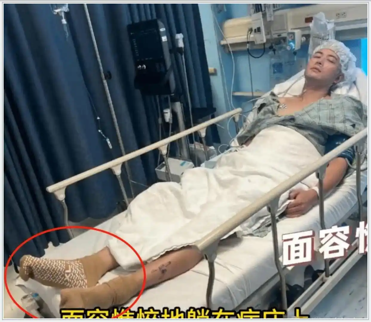 陈学冬照片_陈学冬车祸右脚手术经历_陈学冬小时代角色重合